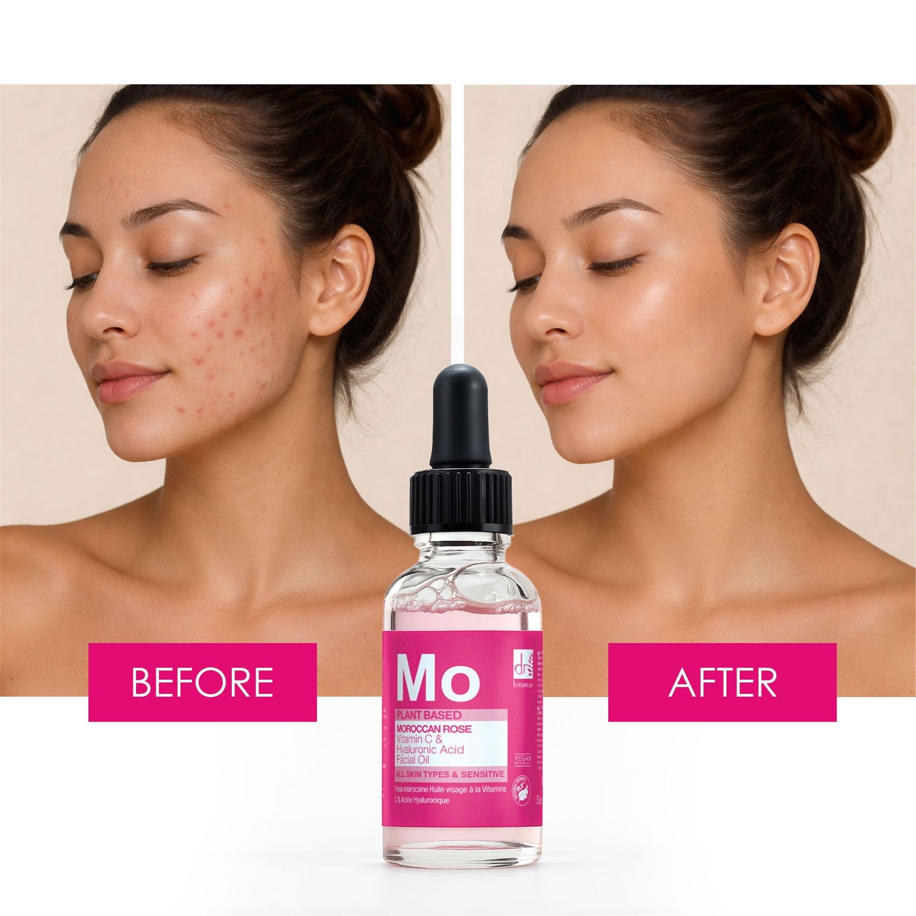 Moroccan Rose Facial Oil with Hyaluronic Acid & Vitamin C 30ml