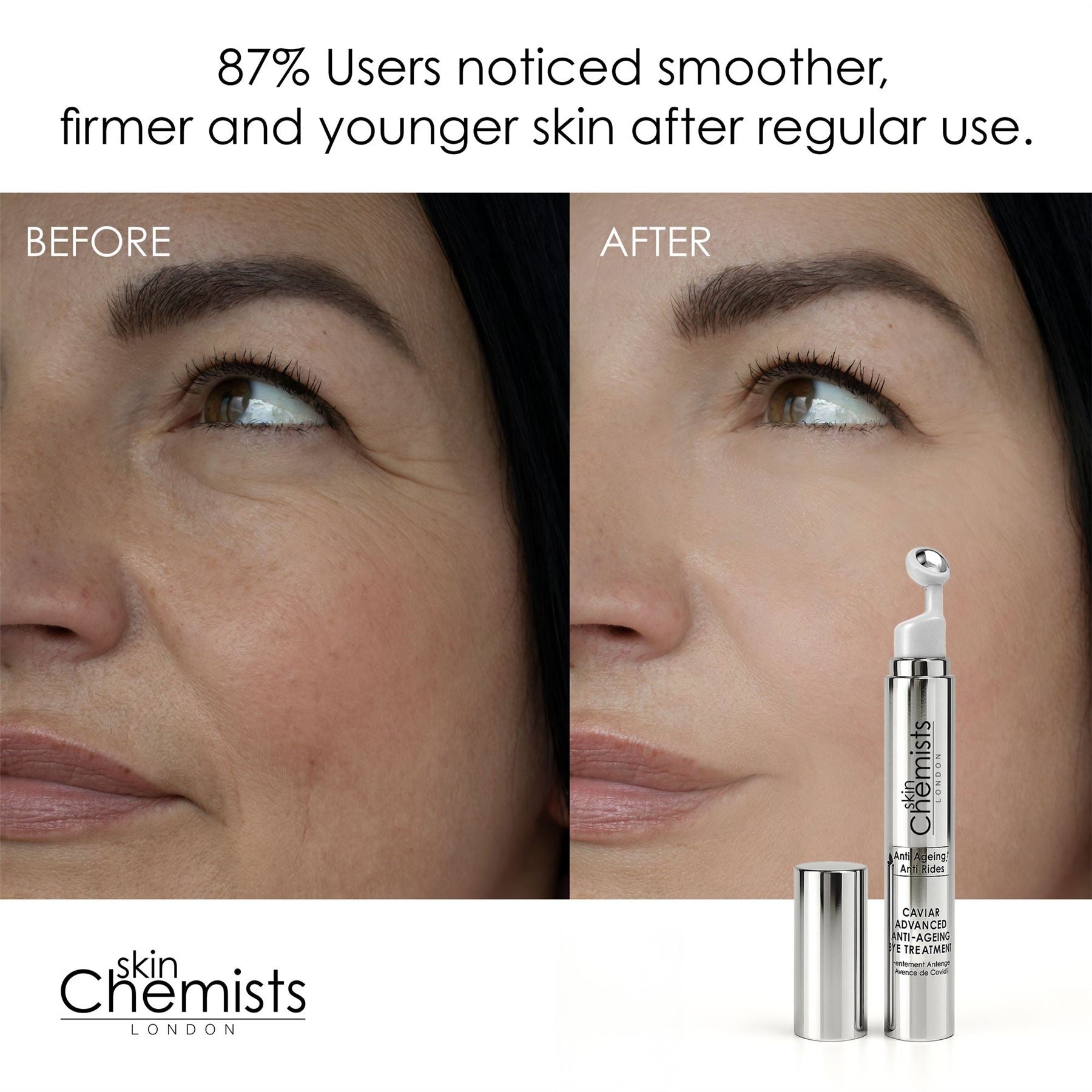 Caviar Advanced Anti-Ageing Eye Treatment 15ml