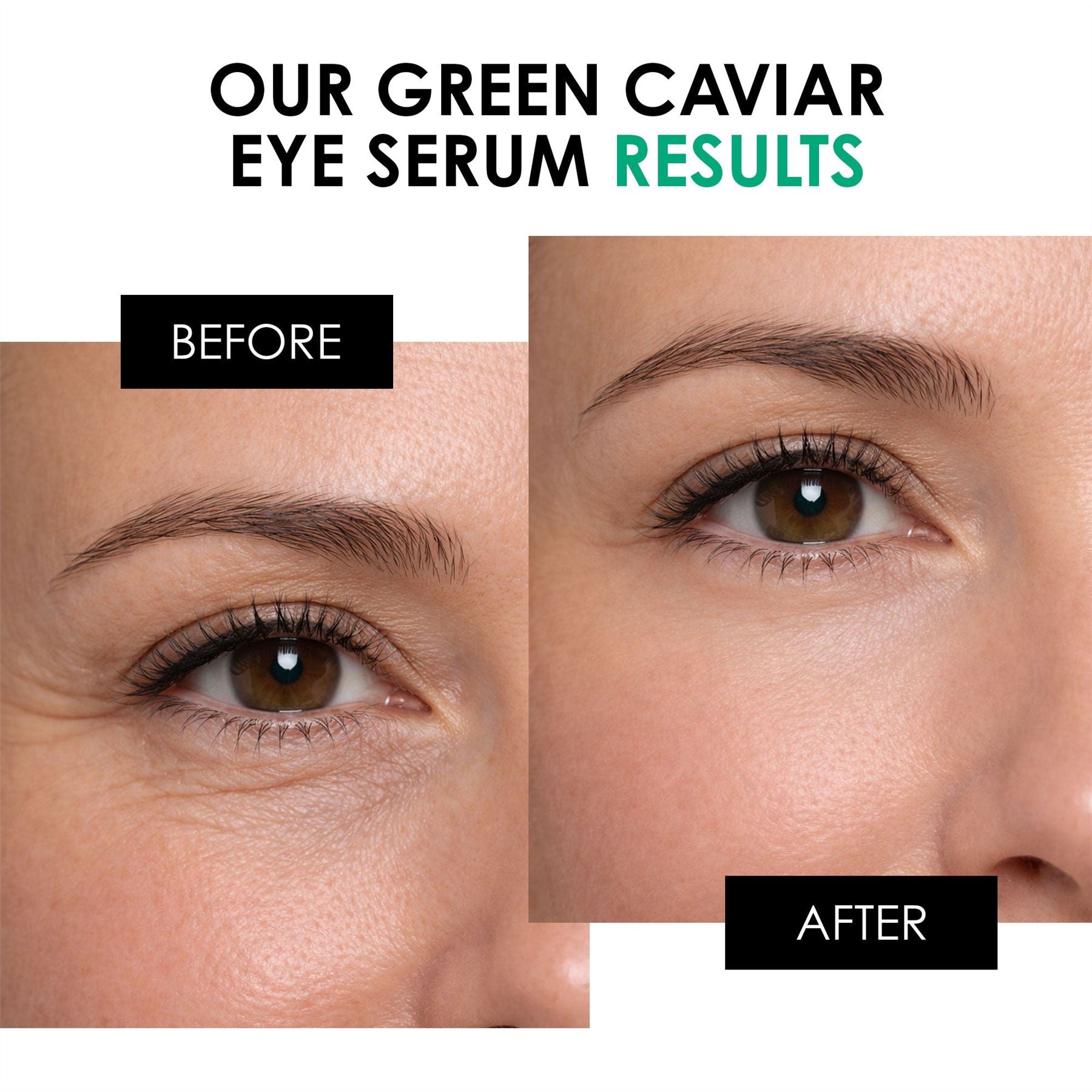 Youth Series Green Caviar Augenserum 15 ml