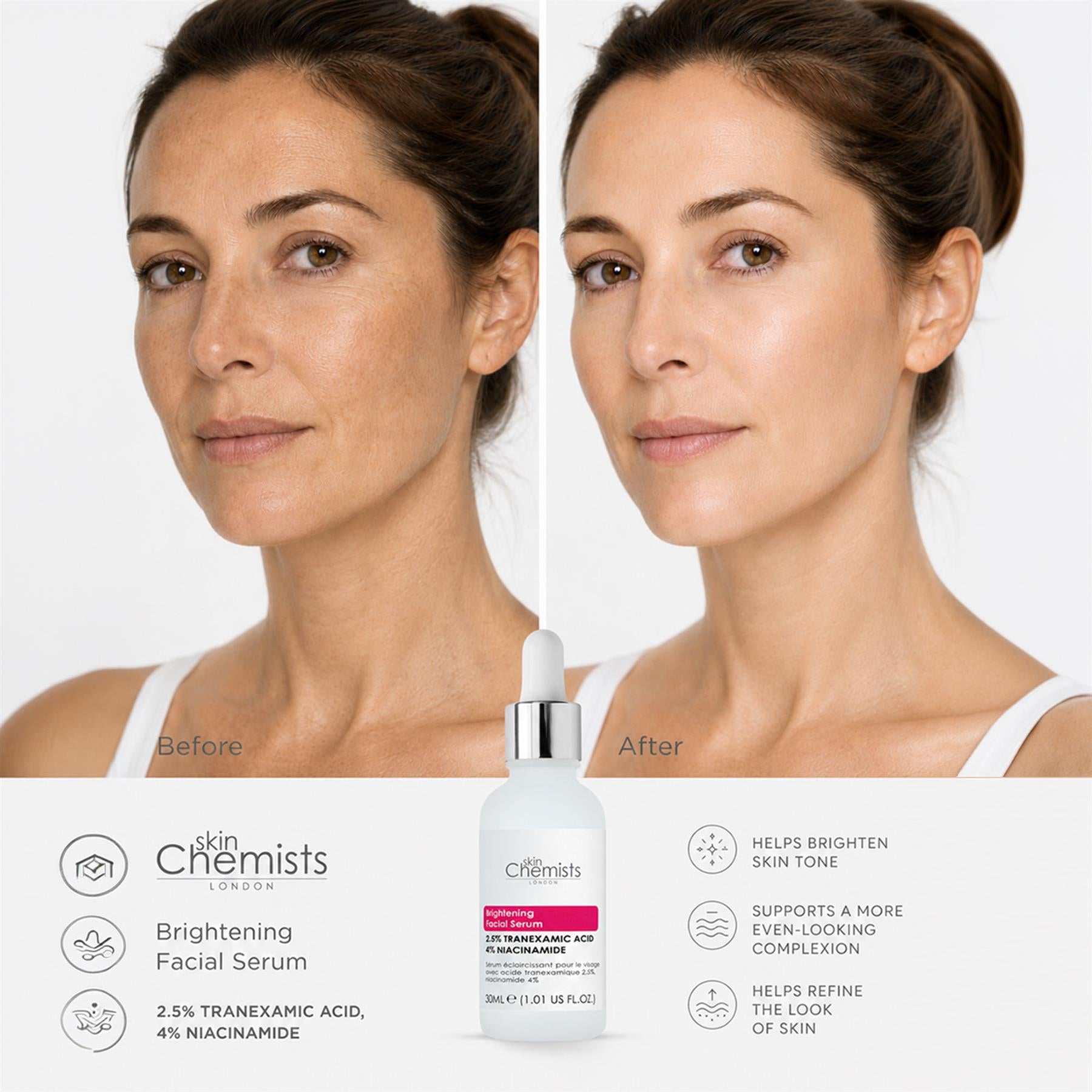 skinChemists Aufhellendes Gesichtsserum mit 2,5 % Tranexamsäure und 4 % Niacinamid, 30 ml