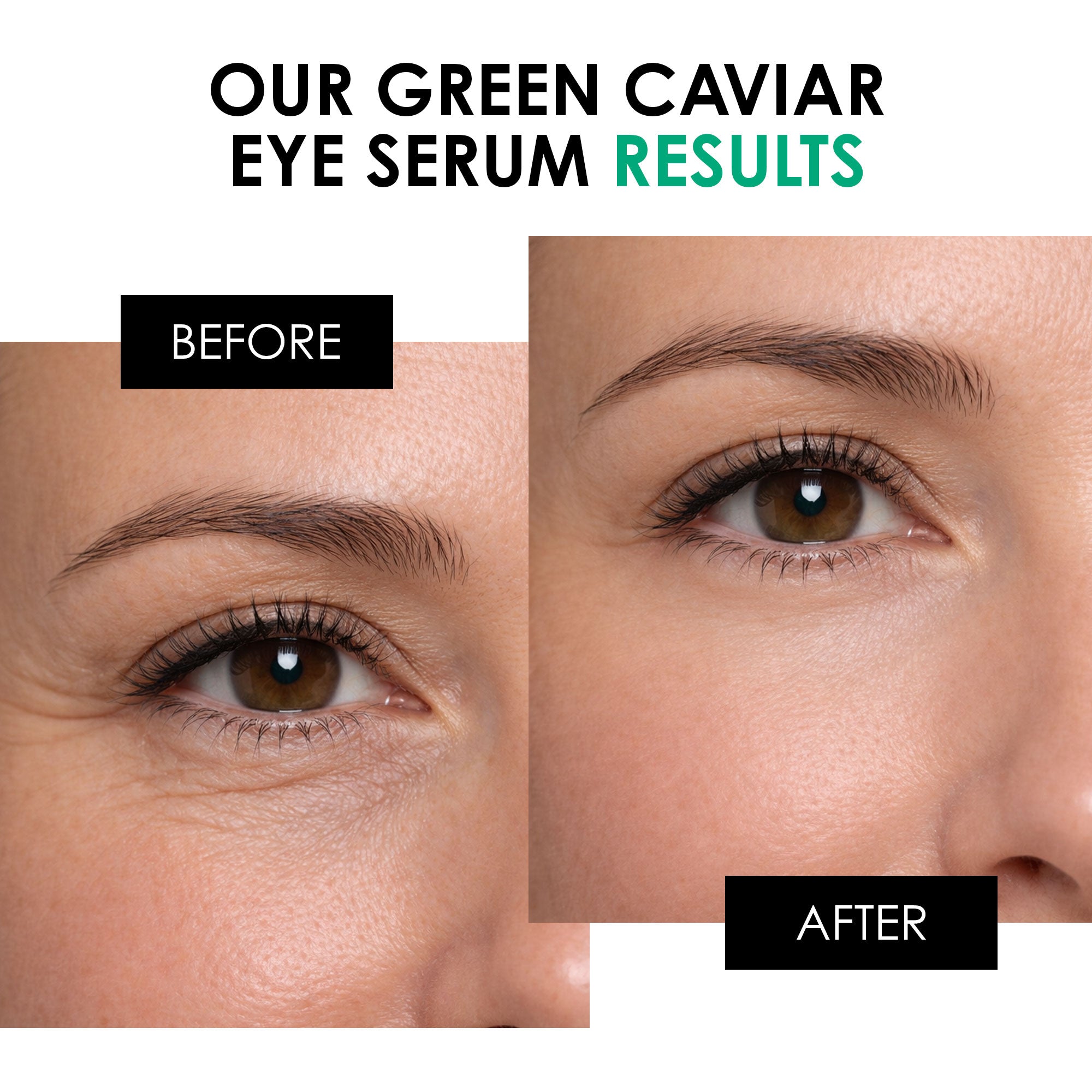 Youth Series Green Caviar Augenserum 15 ml