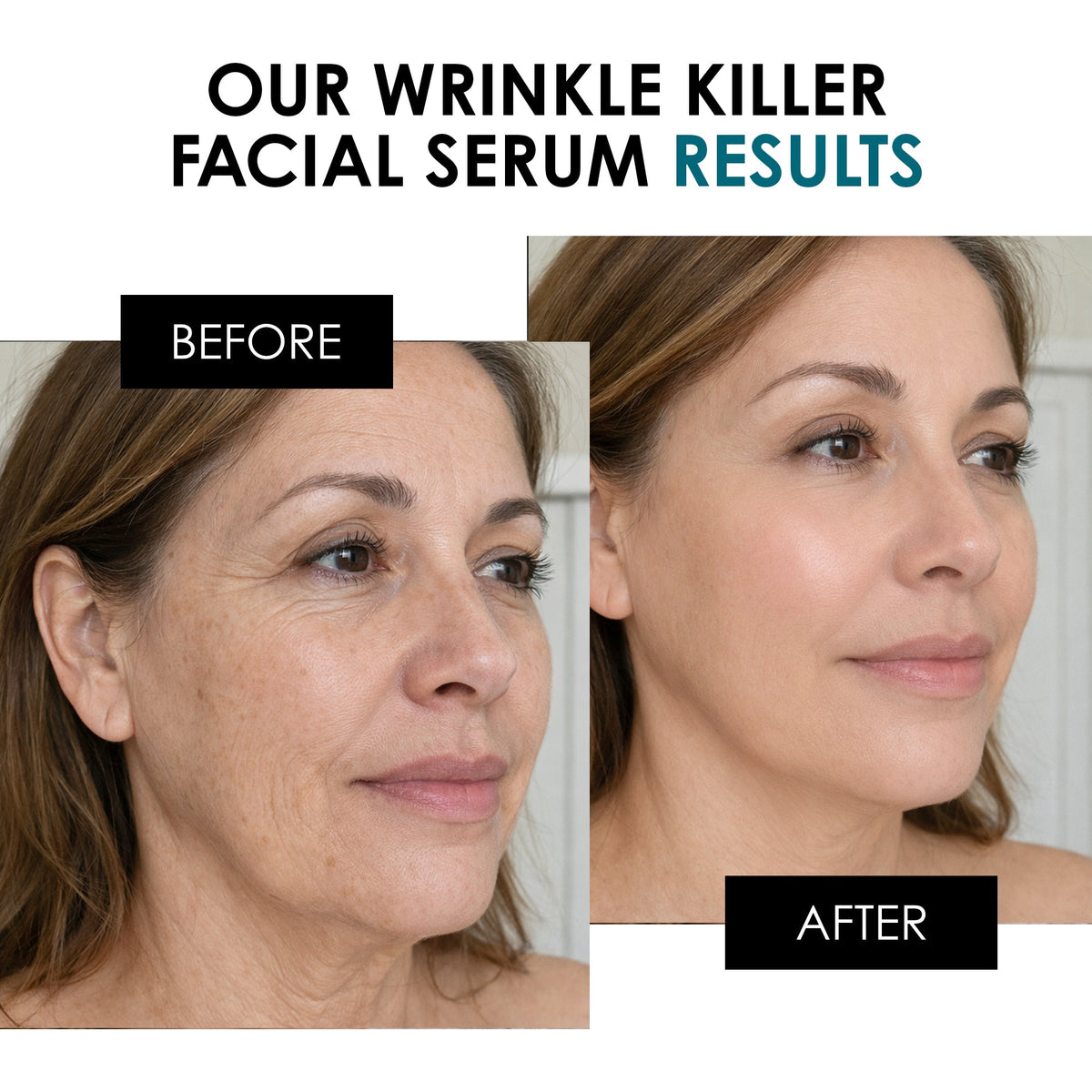 SC Wrinkle Killer Facial Serum 30ml - skinChemists